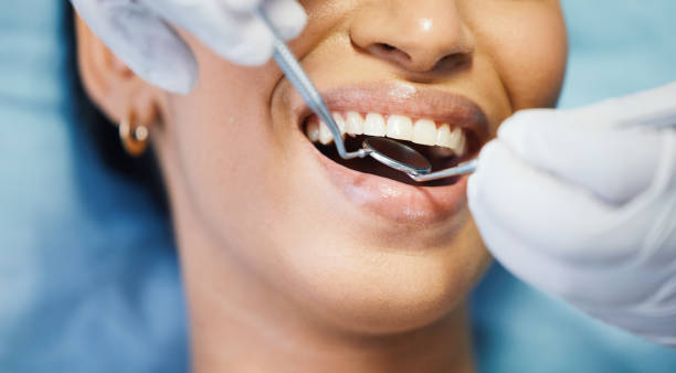 Best Broken or Chipped Tooth Repair in Greenock, PA